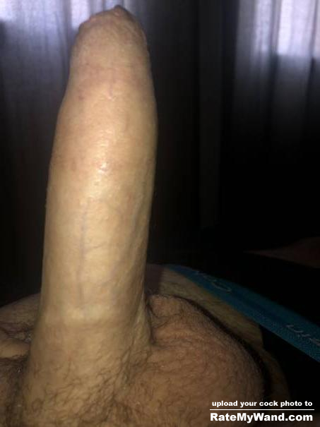 Need my foreskin pulled back - Rate My Wand