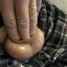 3 fingers in my foreskin :) - Rate My Wand