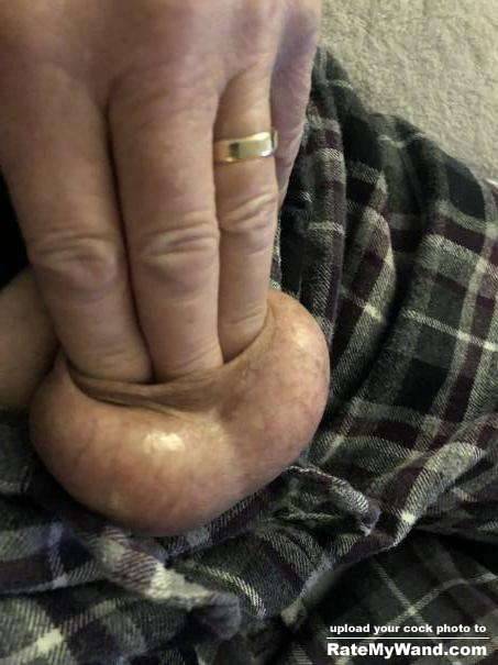3 fingers in my foreskin :) - Rate My Wand