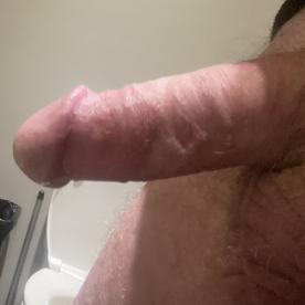 The vein in my cock aren to mu?? - Rate My Wand