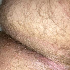 Hairy close up - Rate My Wand