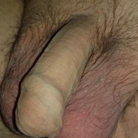 My soft Unpeeled cock and big balls - Rate My Wand