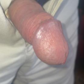 My bare circumcised cock, any takers? - Rate My Wand