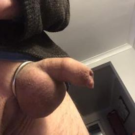 Starting to get a bit of loose foreskin due to my stretching :) - Rate My Wand